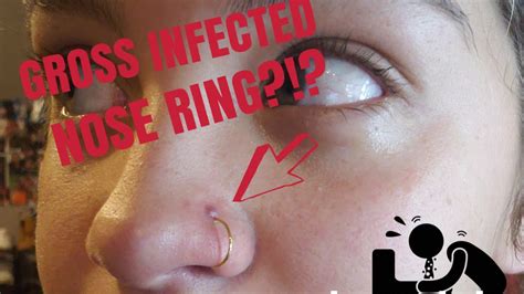 3 Ways to Tell if a Piercing Is Infected